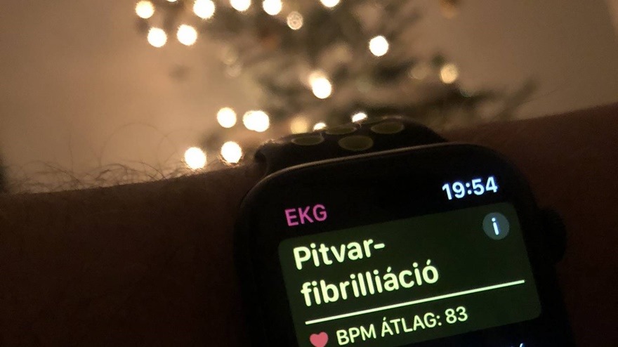 apple_watch_pitvar_fibrillacio
